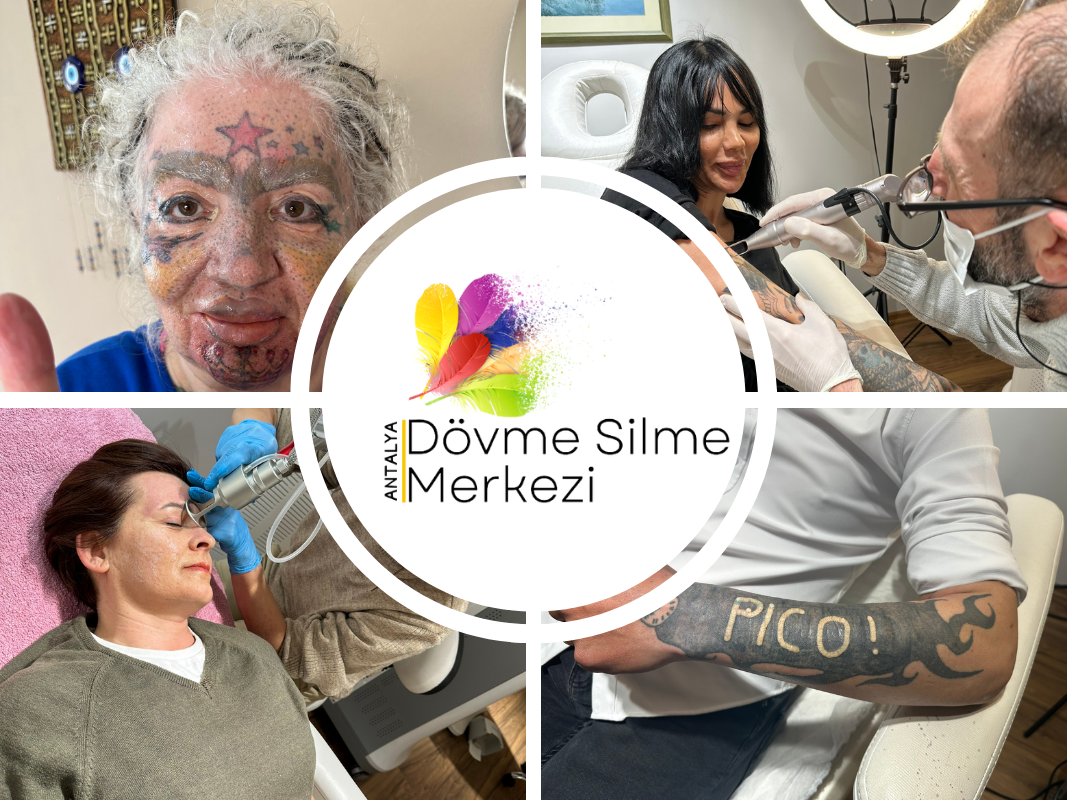 Eyeliner Lazerle Silinir mi? Eyeliner Silme Nasıl Yapılır?